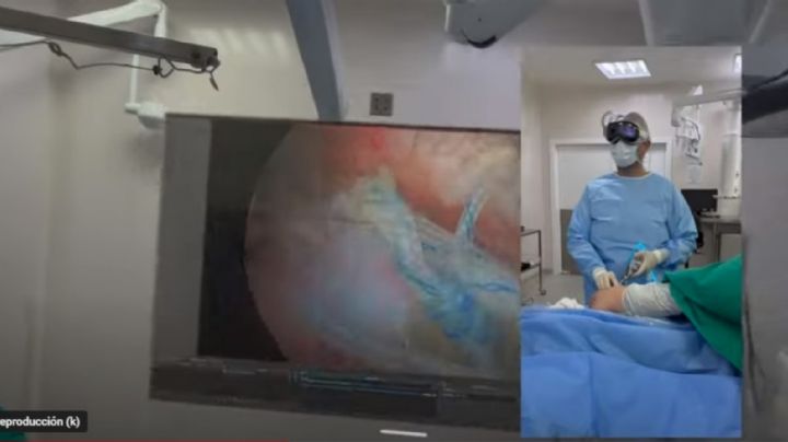 Cirujano realiza una operación usando el Apple Vision Pro y comparte el video