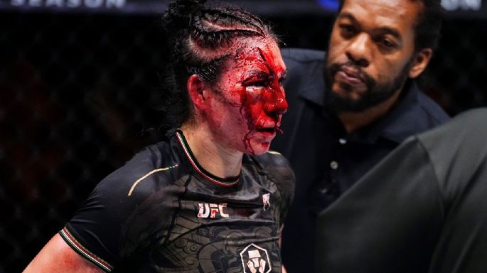 Irene Aldana sufre espeluznante corte en su rostro durante su pelea en la UFC (Video)