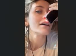 París Jackson admite que la adicción le provocó a su nariz este daño (Video)