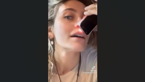 París Jackson admite que la adicción le provocó a su nariz este daño (Video)