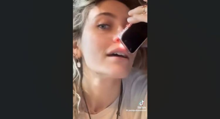 París Jackson admite que la adicción le provocó a su nariz este daño (Video)