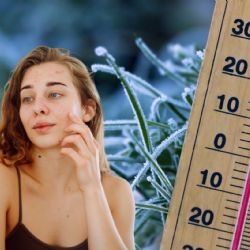 Nutrición y clima frío: alimentos que pueden ayudar a prevenir la piel seca en invierno