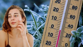 Nutrición y clima frío: alimentos que pueden ayudar a prevenir la piel seca en invierno