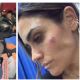 Golpean a Alessandra Rojo de la Vega y a funcionarios; acusa a lideresa de comerciantes (Videos)