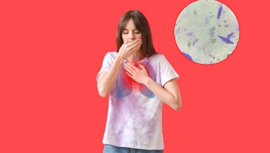 Tos persistente y pérdida de peso: señales que pueden indicar tuberculosis