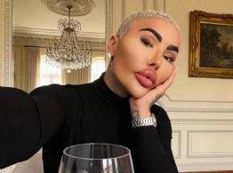 Muere Jordan James Parke, influencer que gastó miles de dólares para parecerse a Kim Kardashian