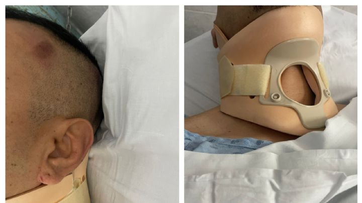 Agentes de la Fiscalía de Guanajuato propinan golpiza a reportero en Juventino Rosas