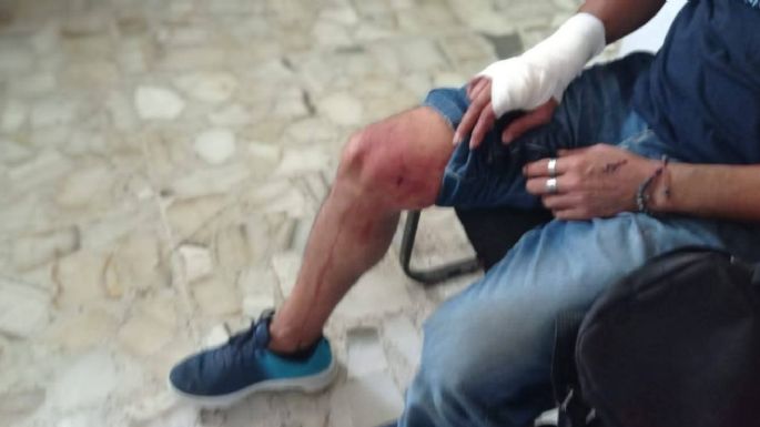 Francisco Magaña, reportero de Guerrero, sufre intento de homicidio con un arma blanca