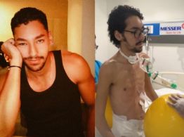 Despertó sin poder mover los brazos: la enfermedad que dejó cuatro meses paralizado a un joven